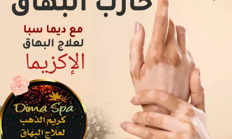 alanat.net6481eb227e796